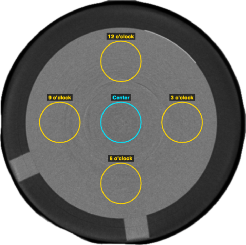 Image uniformity: centre and peripheral regions on a uniform phantom